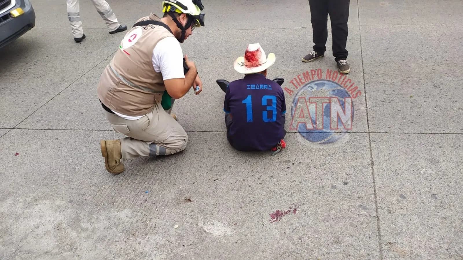Se cayó y se lastimó la cabeza