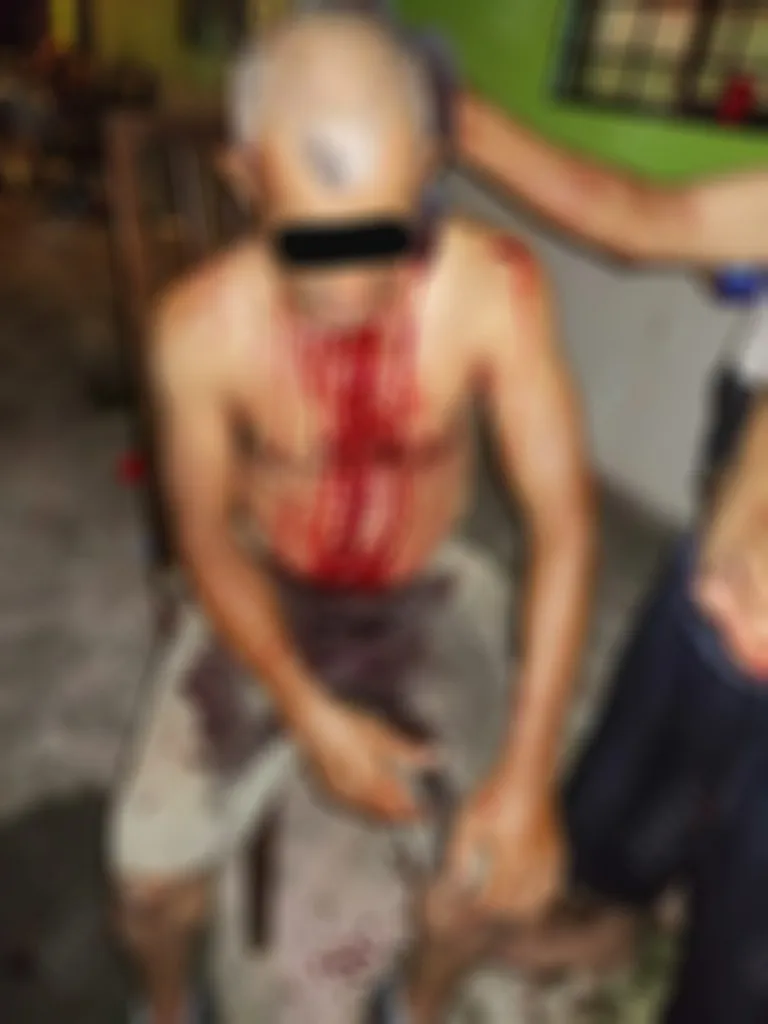 Lesionó a su suegro con un vidrio tras una riña