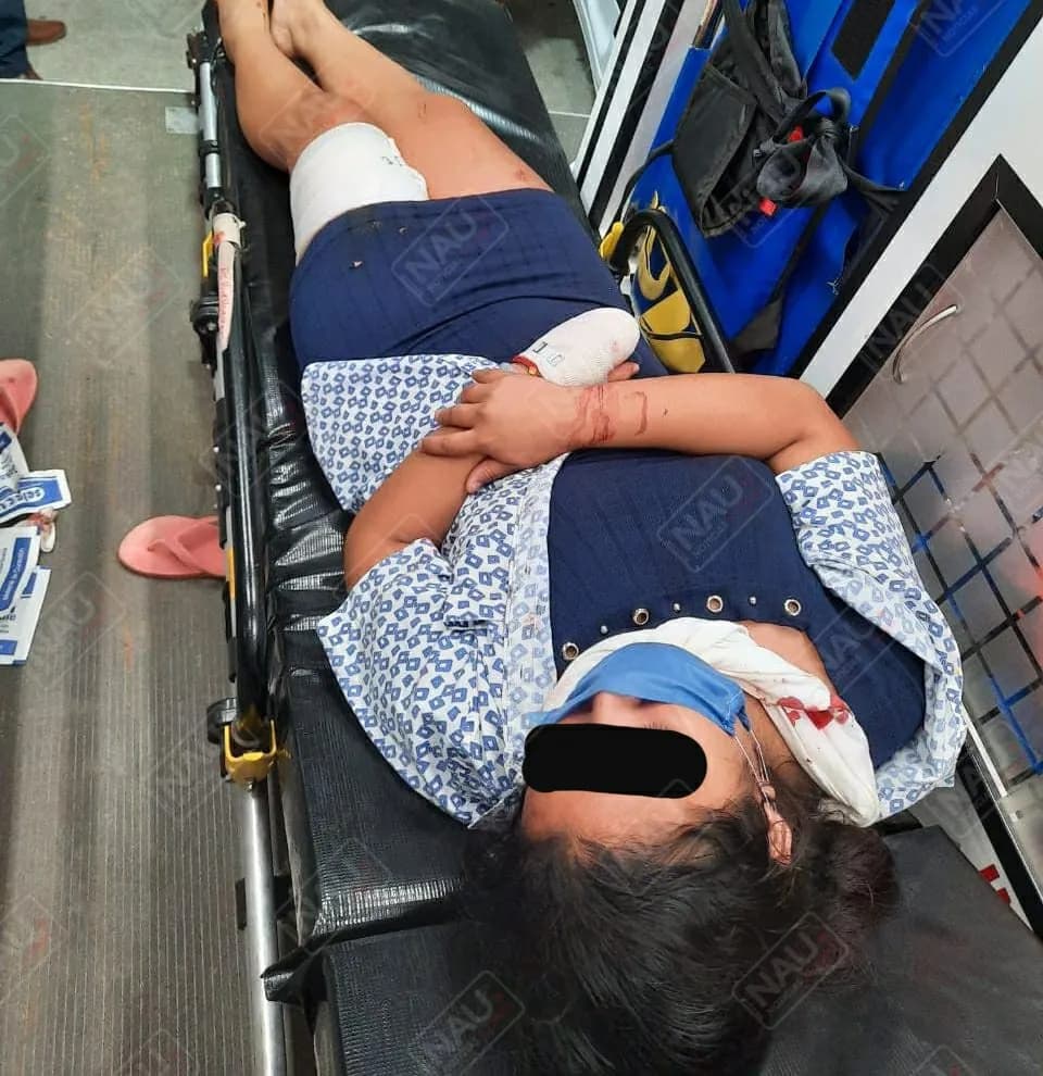 Lesionan a balazos a una mujer en Huehuetán, en un intento de asalto