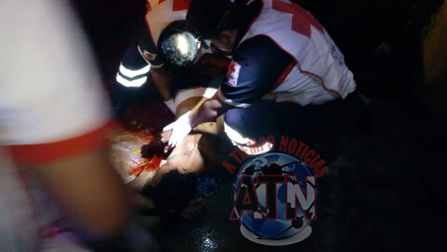 Lesionan de un balazo en el glúteo y abdomen a hondureño