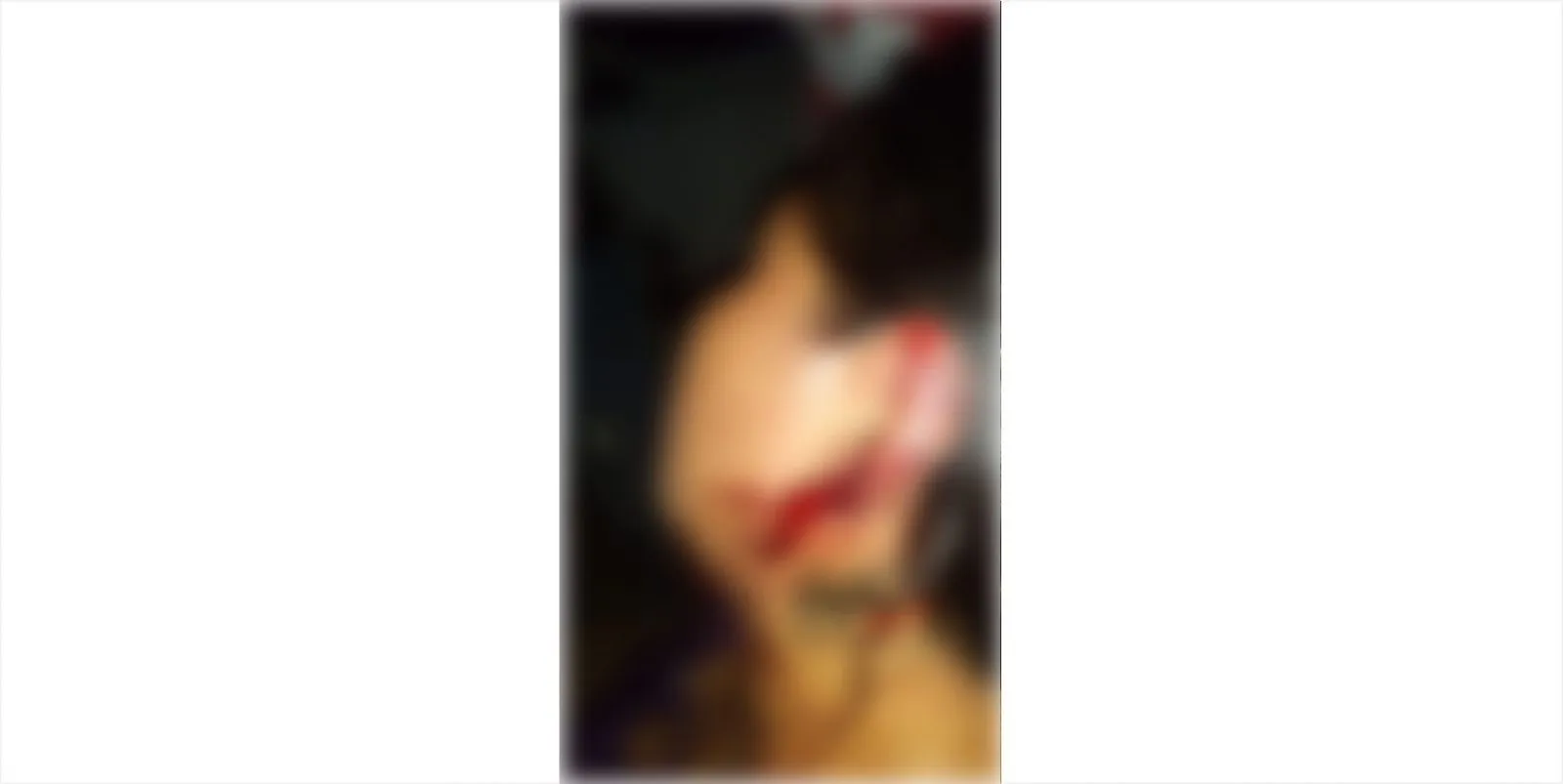 Su vecino los lesionó con un machete en Tuxtla Chico