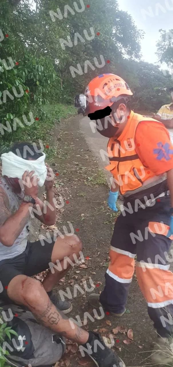 Accidente en motocicleta deja a dos heridos en Tapachula, Chiapas