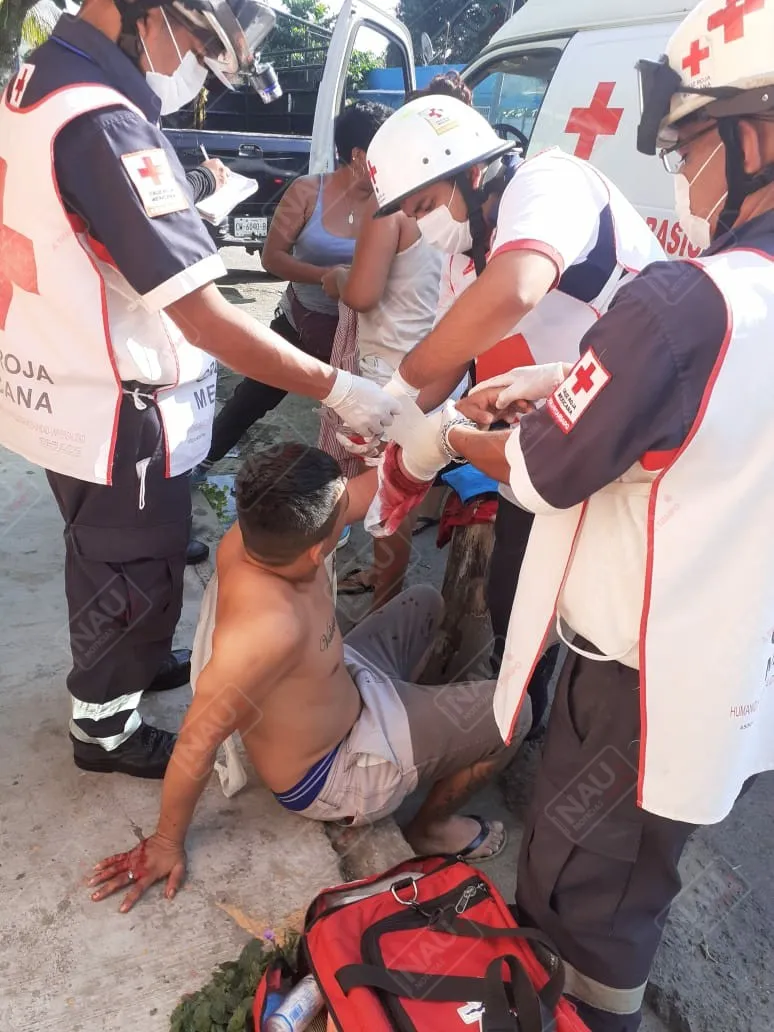 Podaba su césped y se cortó por accidente