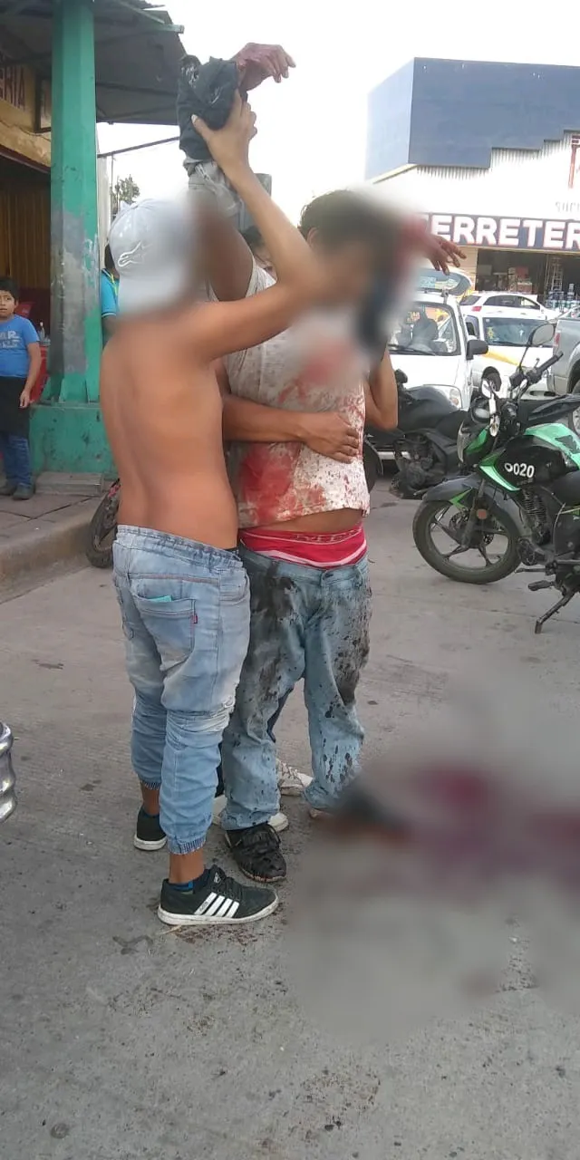 Su compañero de parranda a quien conoce solo de vista, le invitó una cerveza y después intento asesinar.