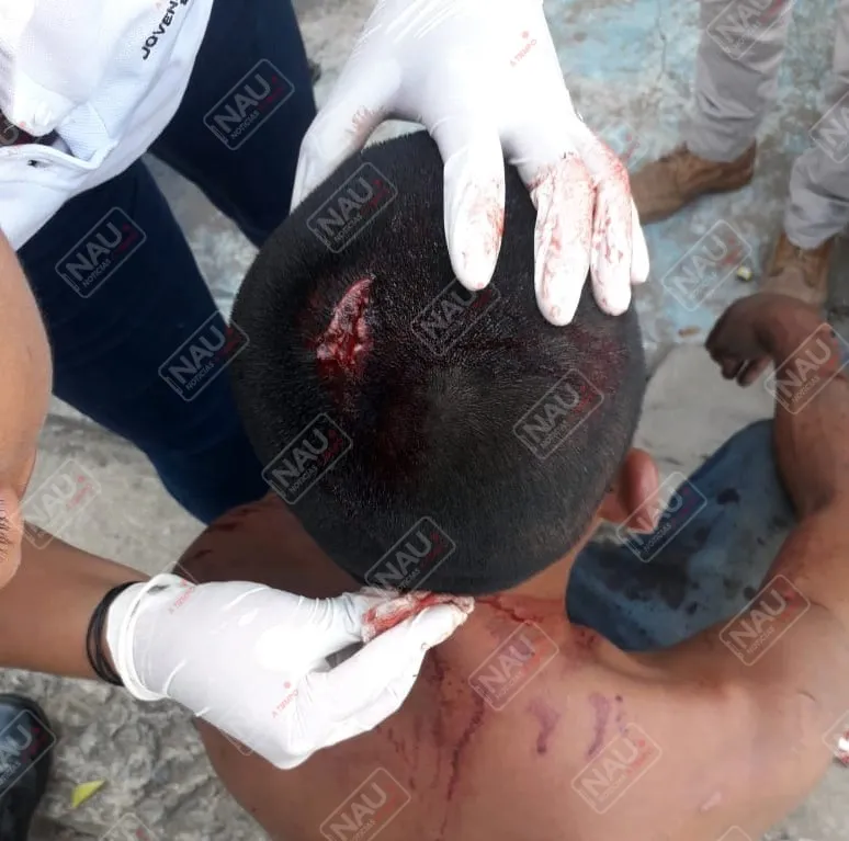 Cayó de su propio peso