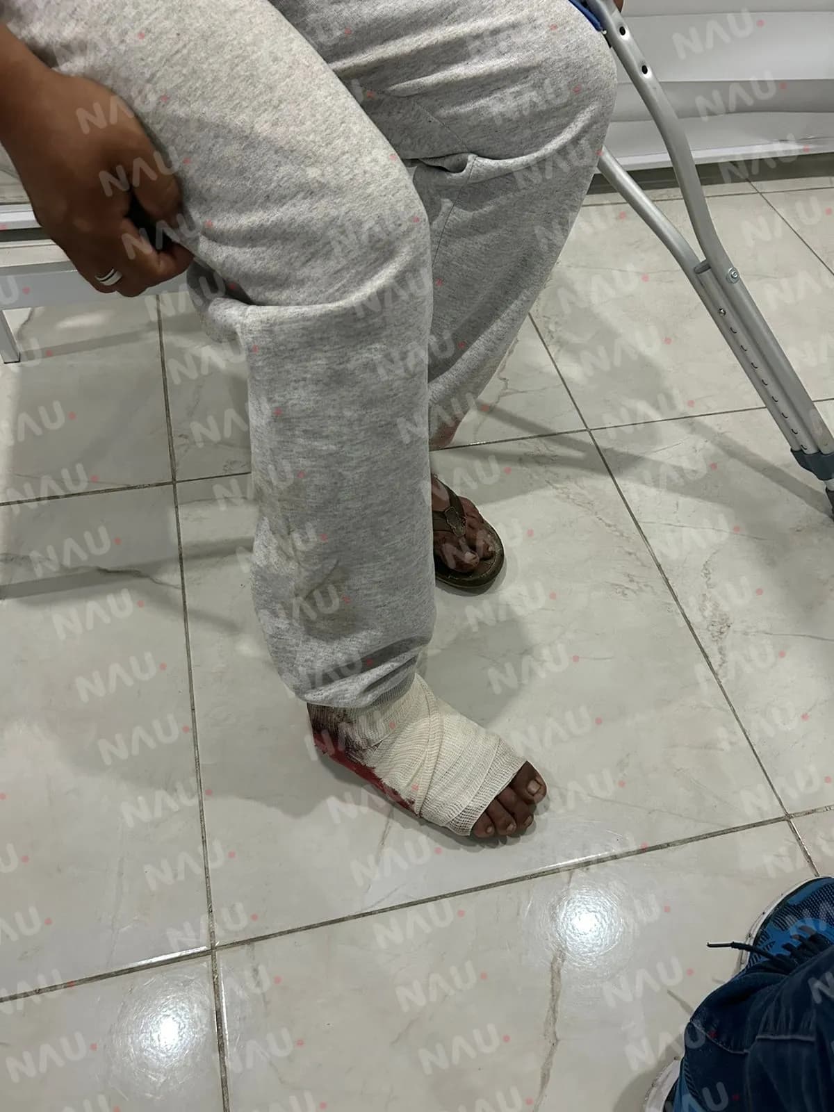 Presuntos elementos castrenses disparan en el pie a campesino en Tapachula, Chiapas