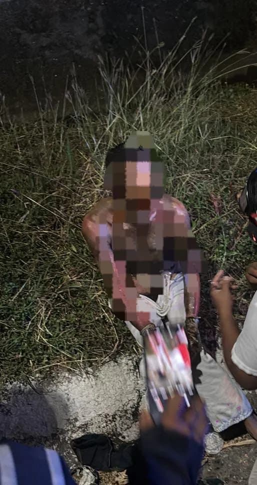 Muere hombre con quemaduras tras accidente con combustible en Tapachula