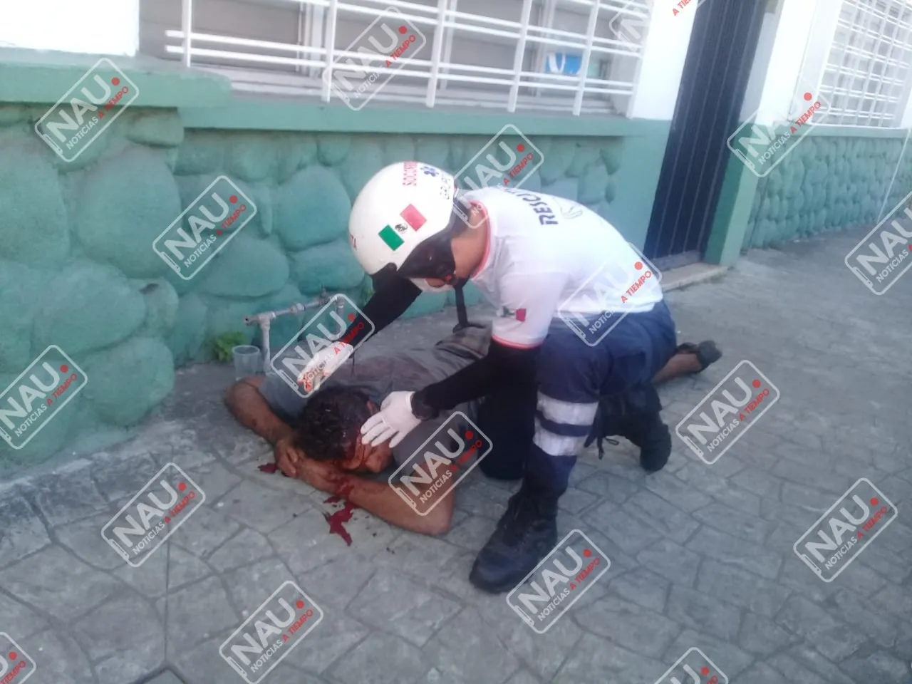 Salvadoreño fue golpeado en la cabeza para robarle sus pertenencias