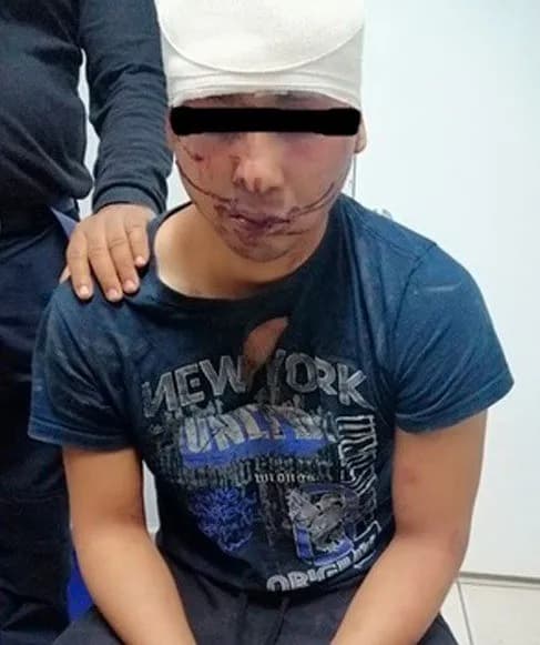 Joven que atacó a sus abuelos se encontraba en un anexo