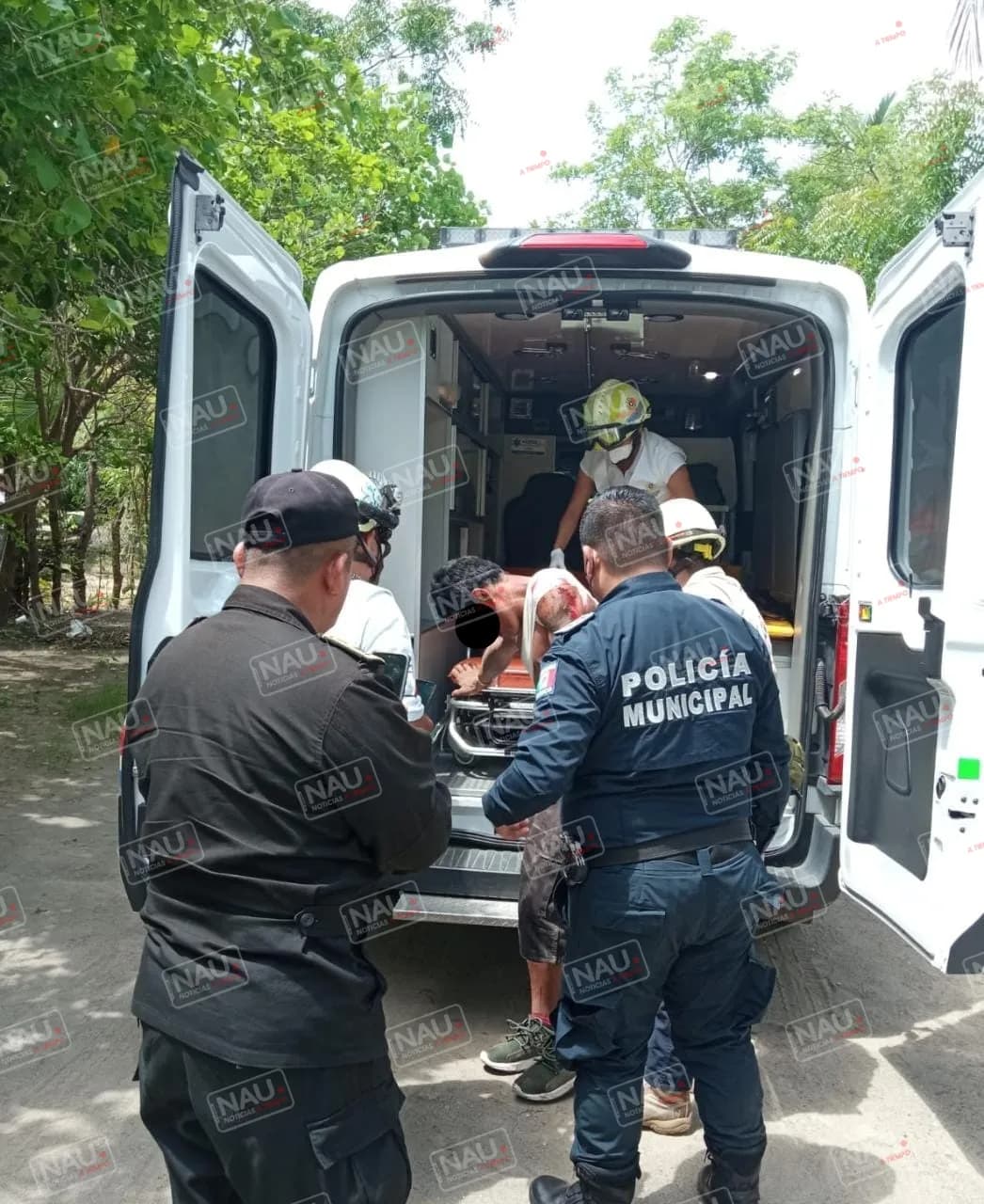 Le dieron un machetazo en una riña en Puerto Madero