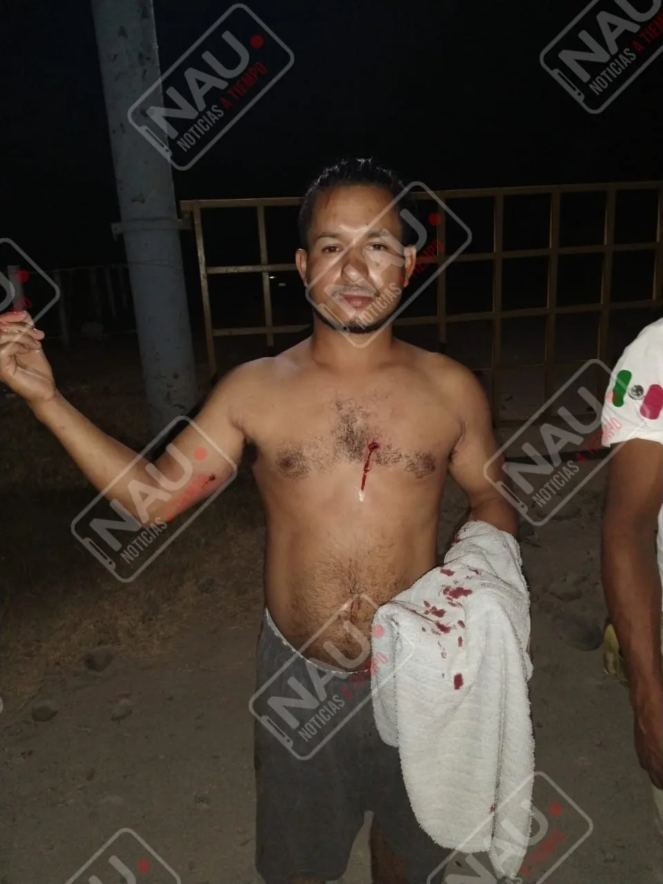 Le dispararon para robarle su motocicleta en Mazatán