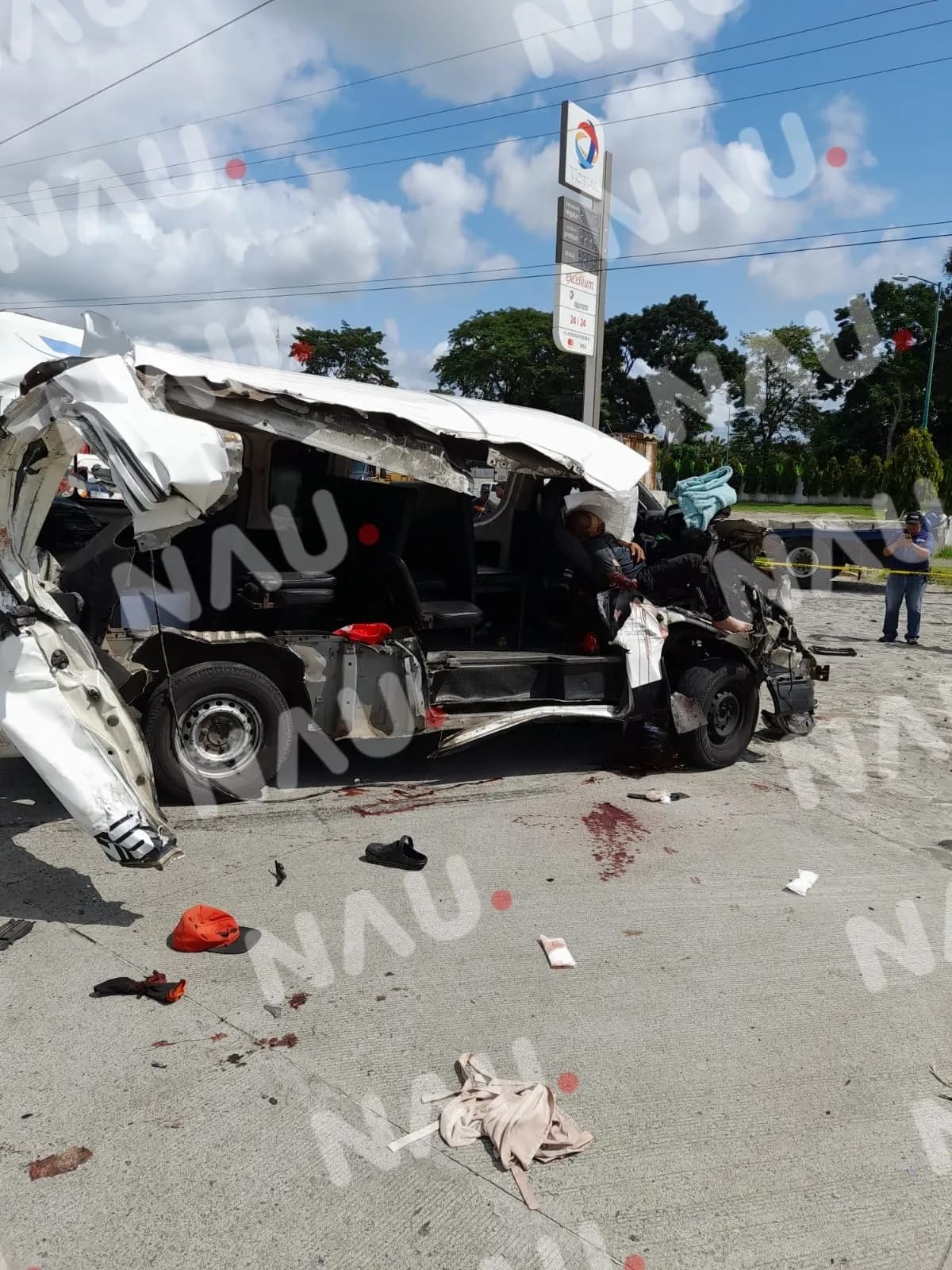 Una pasajera venezolana se encuentra entre la vida y la muerte del accidente en Suchiate