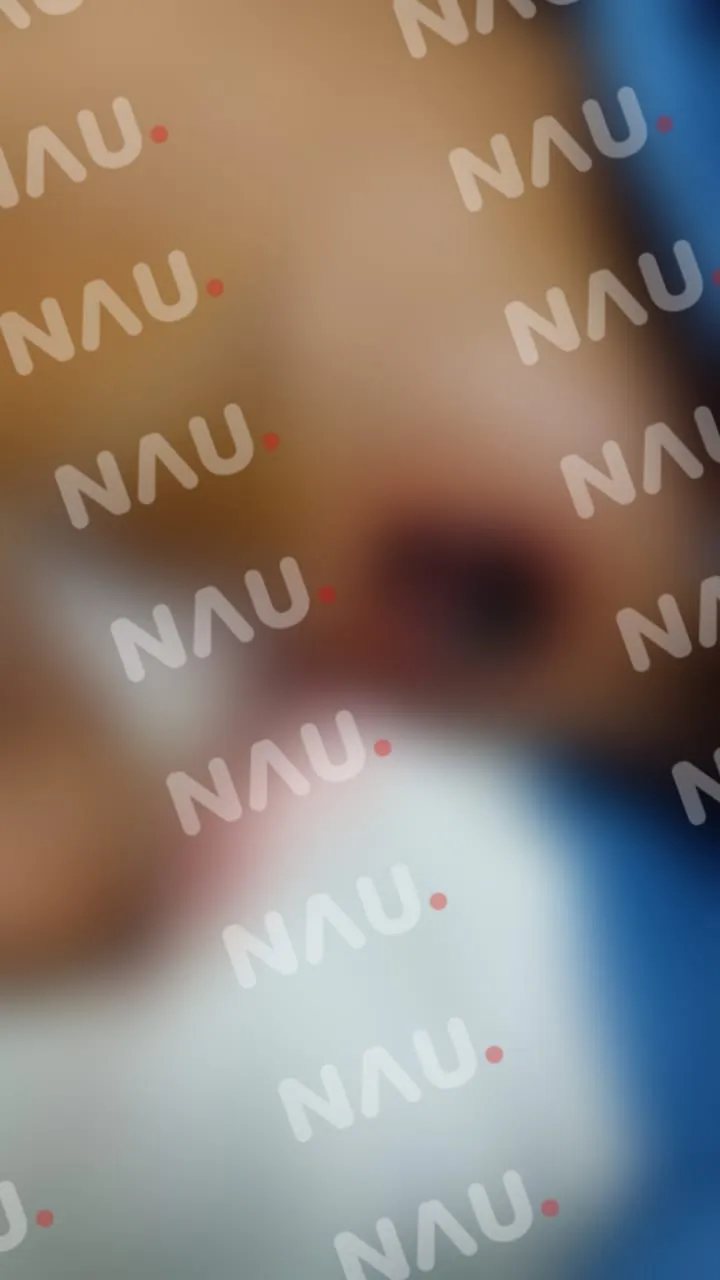 Víbora tamagas ataca a Menor de 7 años en Mapastepec