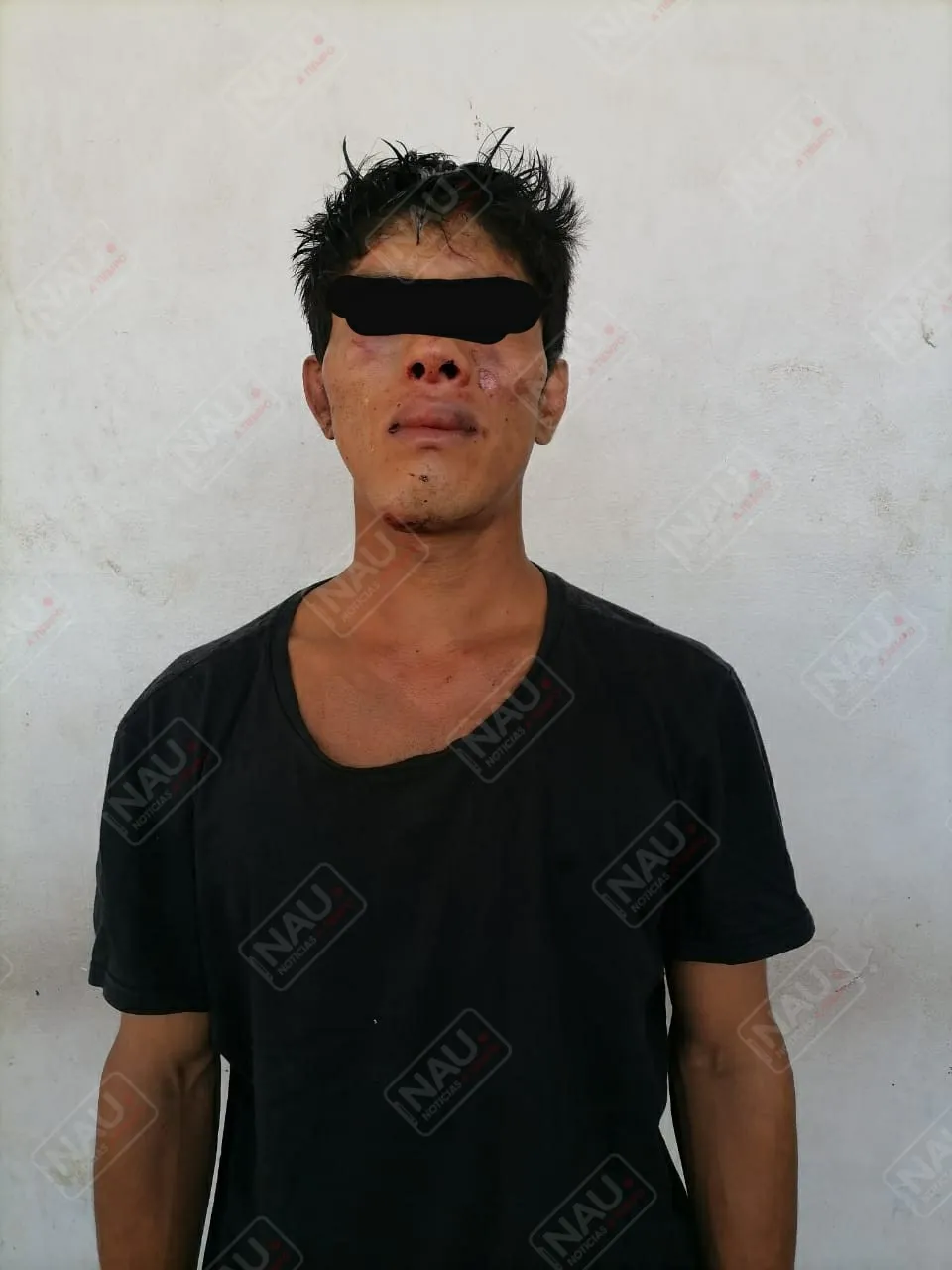 Salvadoreño lesionó con cuchillo a despachador de gasolina Repsol en asalto