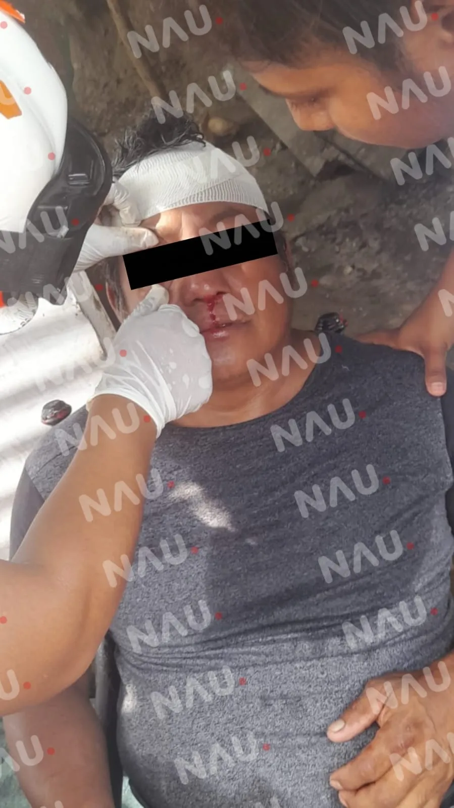 En riña golpean a una persona en el ejido Pacayalito