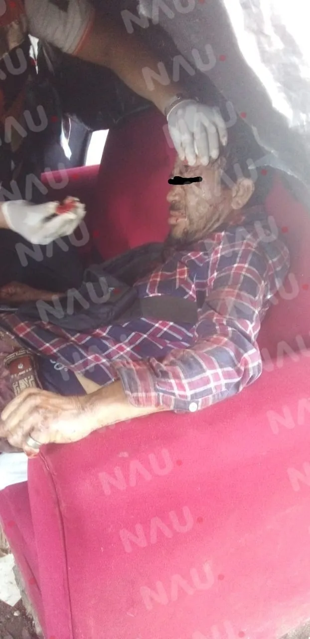 Lo lesionaron en una riña callejera