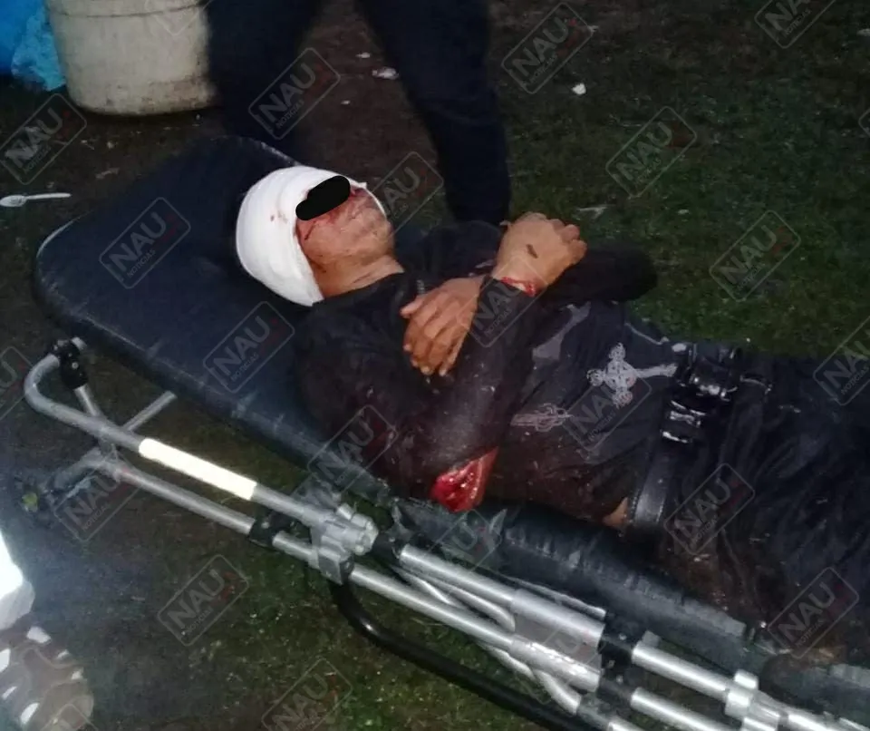 Ingresó al HG de Tapachula, fue macheteado por su amigo de parranda