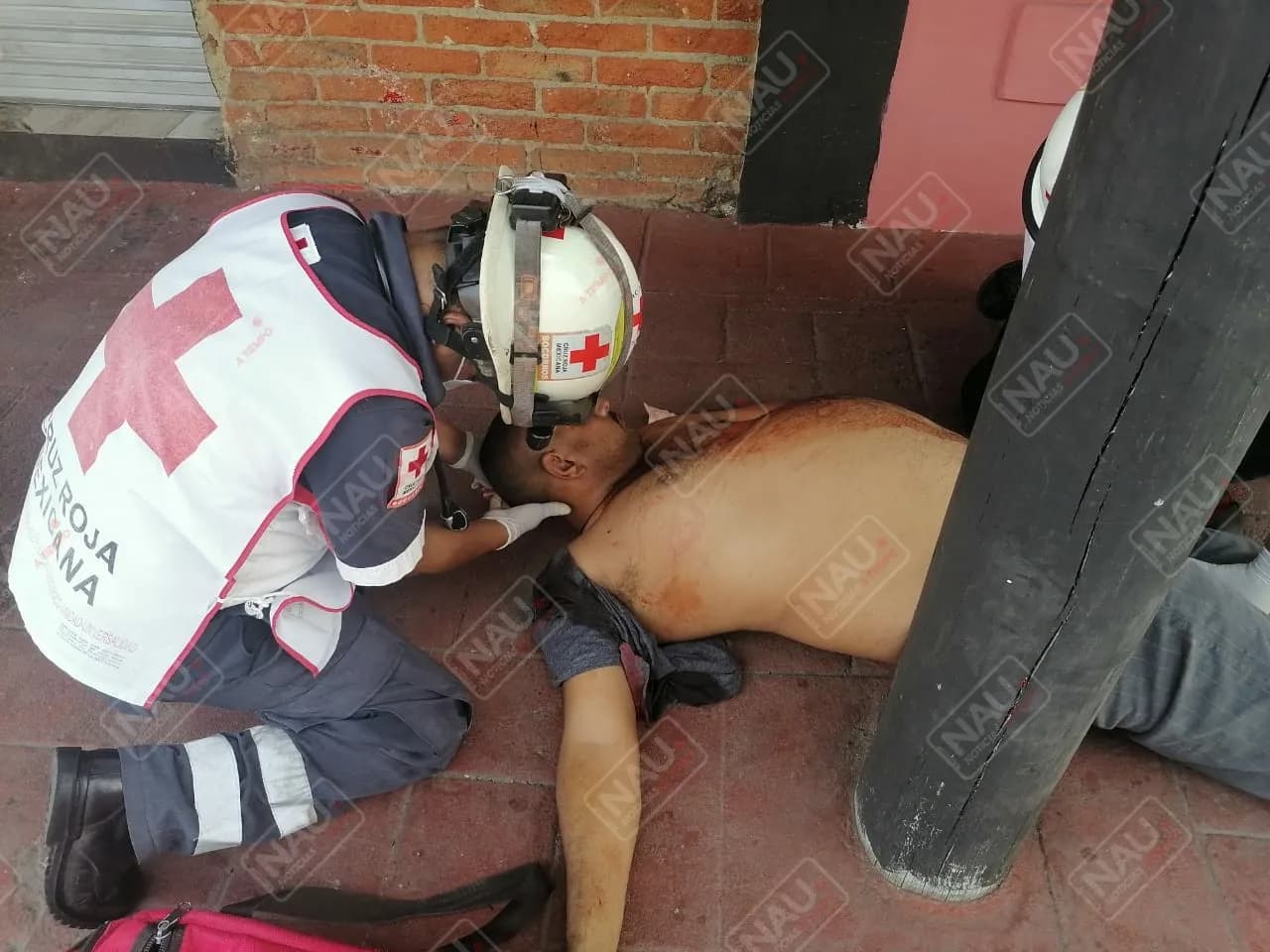 Lo lesionaron con un picahielo en la cabeza
