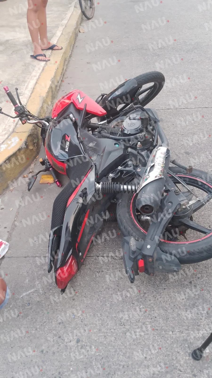 Accidente de motocicletas en Tapachula deja un herido grave