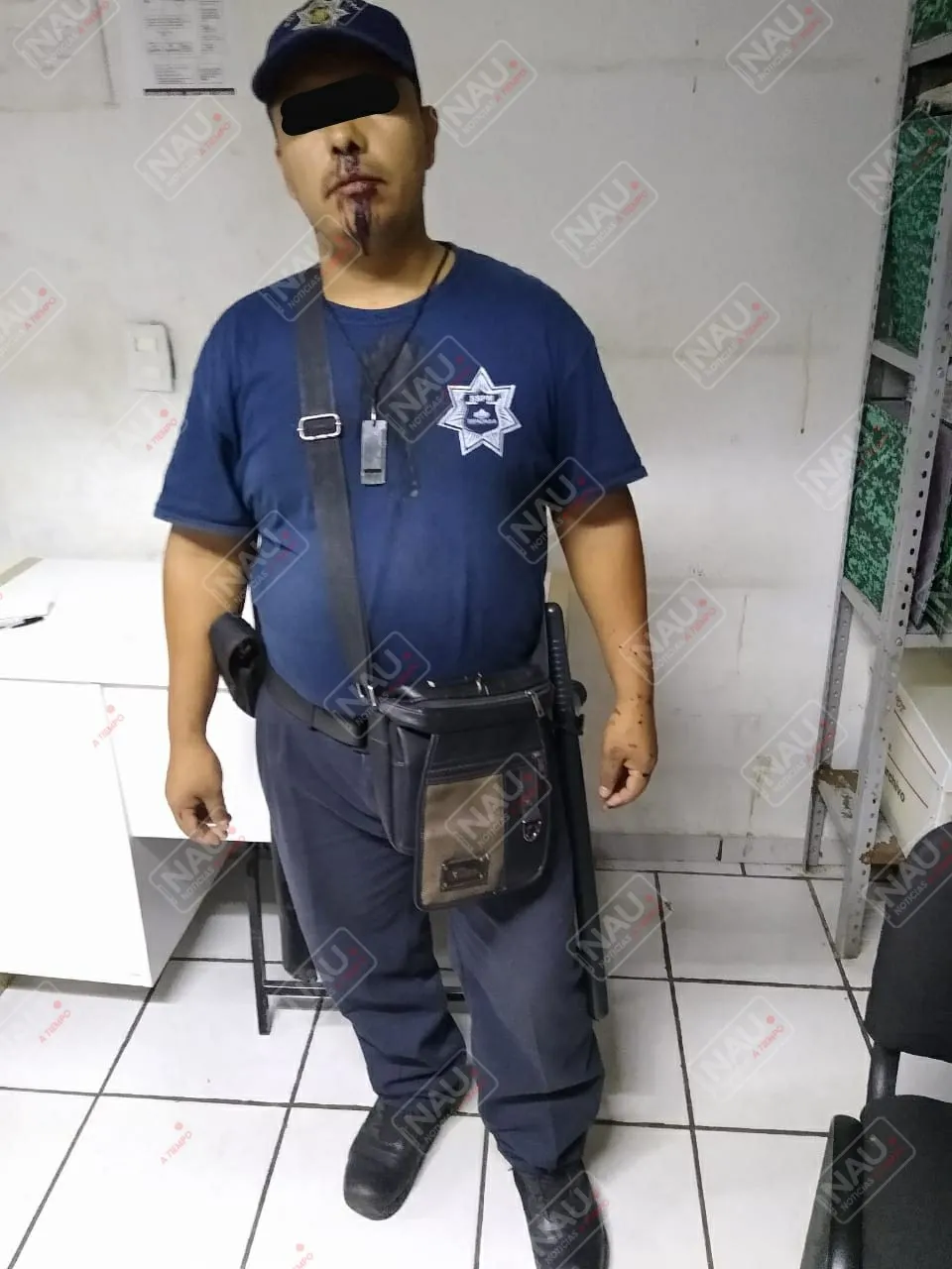 Golpean a vigilante de proximidad en el Fraccionamiento Las Vegas