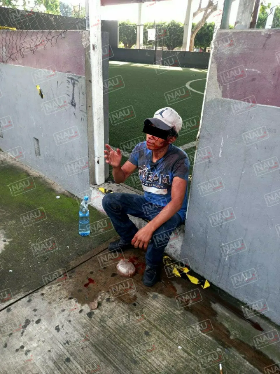 Le dieron una cuchillada en la cabeza tras registrarse una riña en la Colonia 5 de febrero