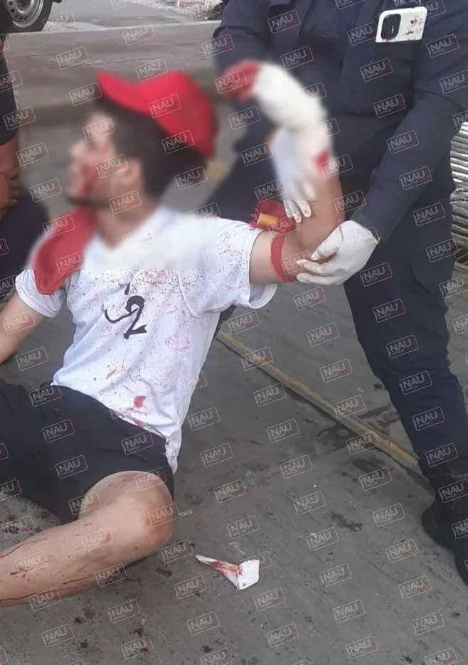 Lesionan a hondureño en una riña en plaza Kafeto.