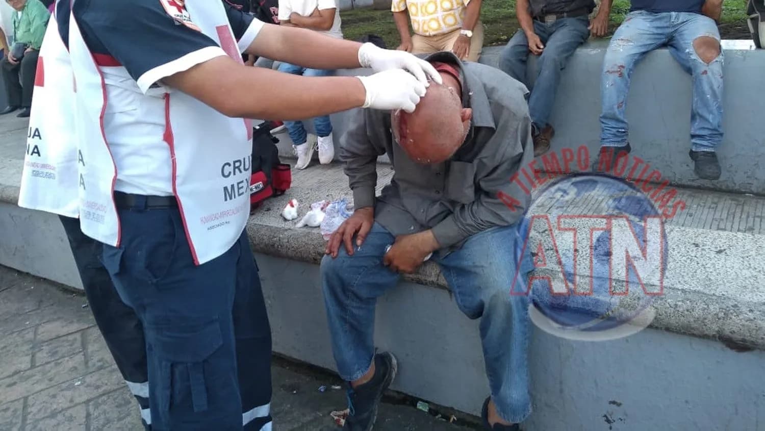 Le rajaron la cabeza por no seguir la parranda