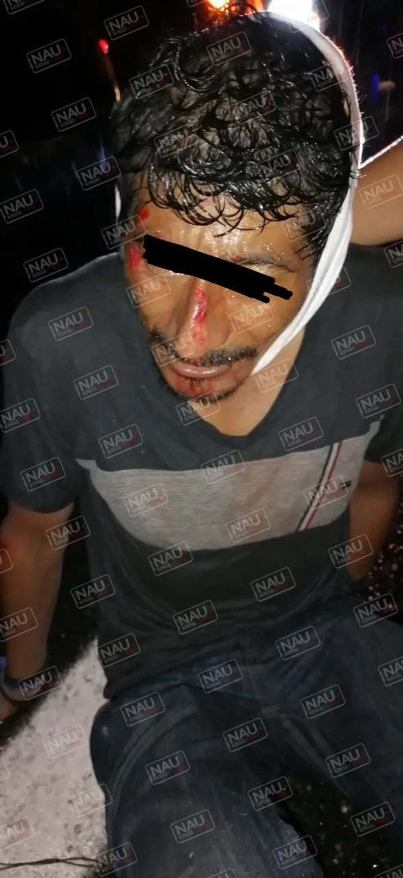 Vehículo no identificado atropelló a una persona en la carretera Tapachula – Jaritas