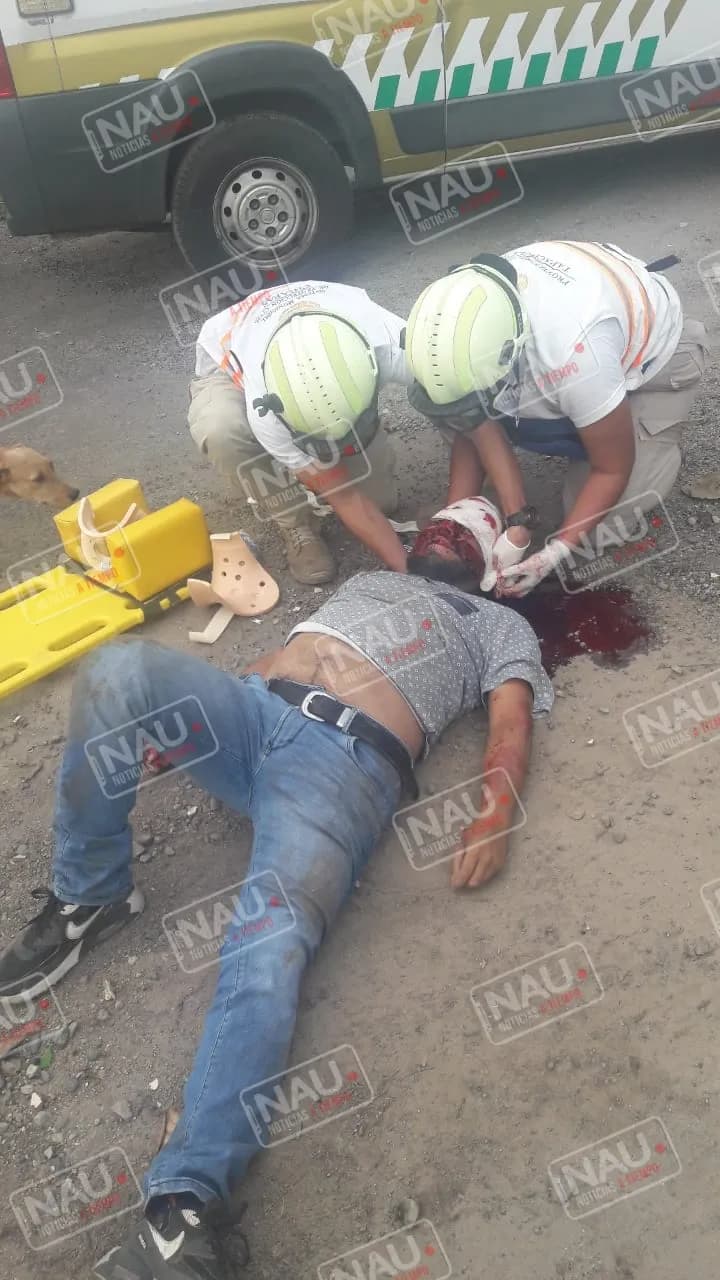 Muere motociclista que ingresó al HGT Manuel Velasco Suárez