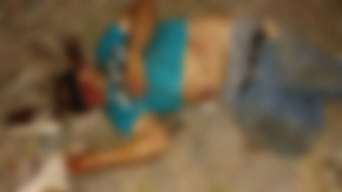 Le dieron dos machetazos en la cabeza en una riña