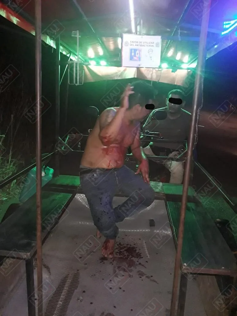 Golpeador de mujer fue lesionado de un machetazo en la mano