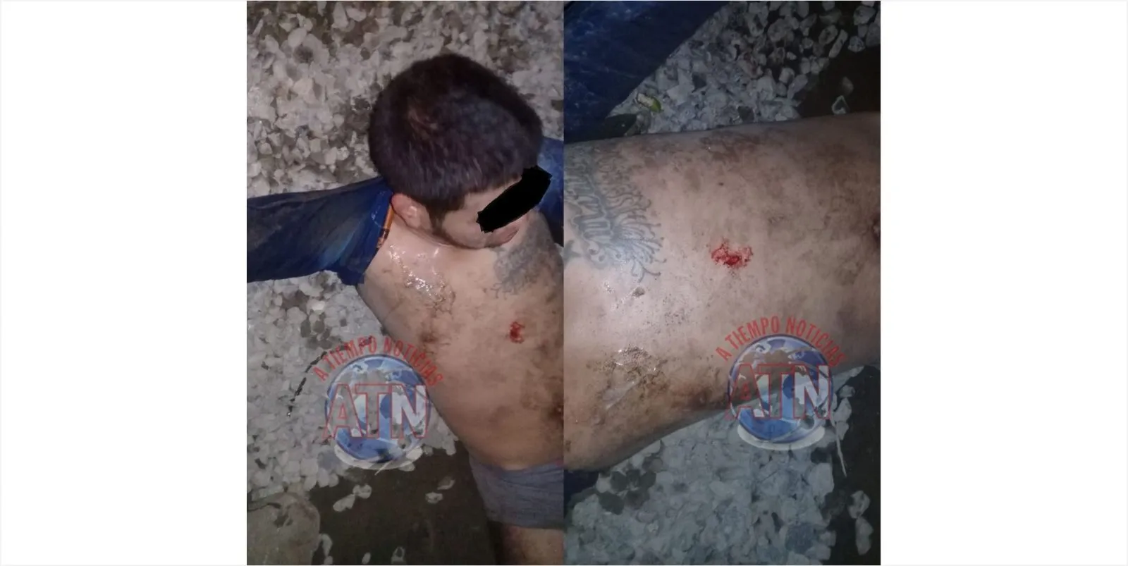 Lesionan a salvadoreño en Raymundo Enríquez