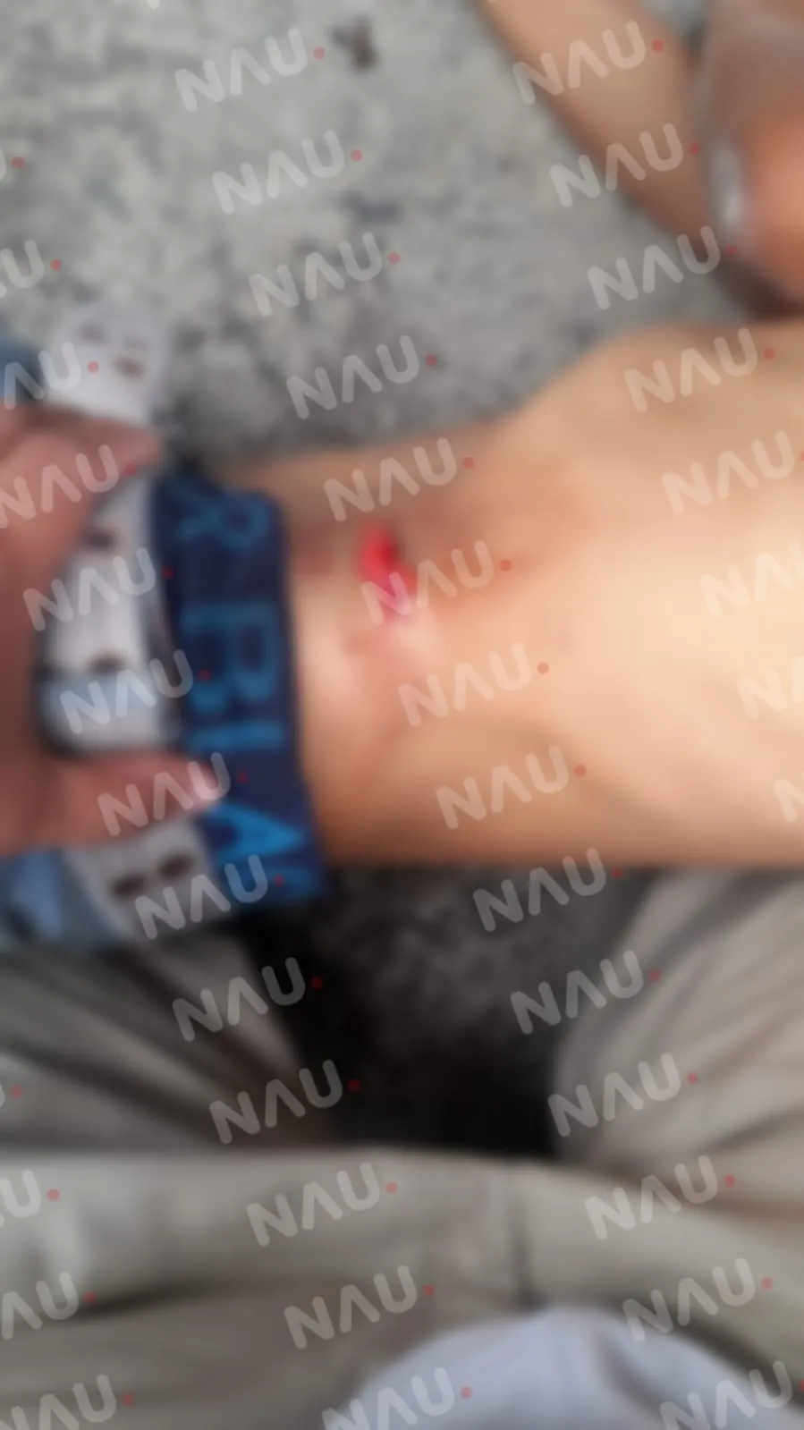 Un lesionado en riña