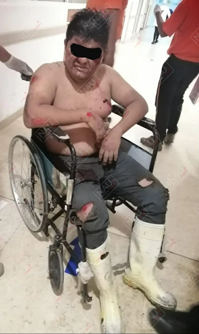 Atropellado quedó tirado en el pavimento de la carretera Tapachula – Puerto Madero