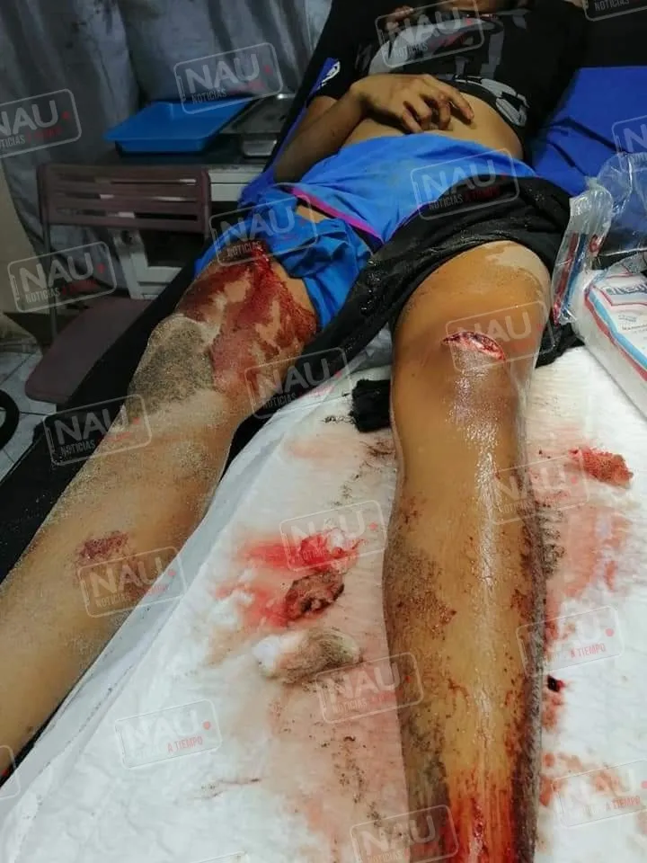 Lesionan a menor que intentaron abusar de ella