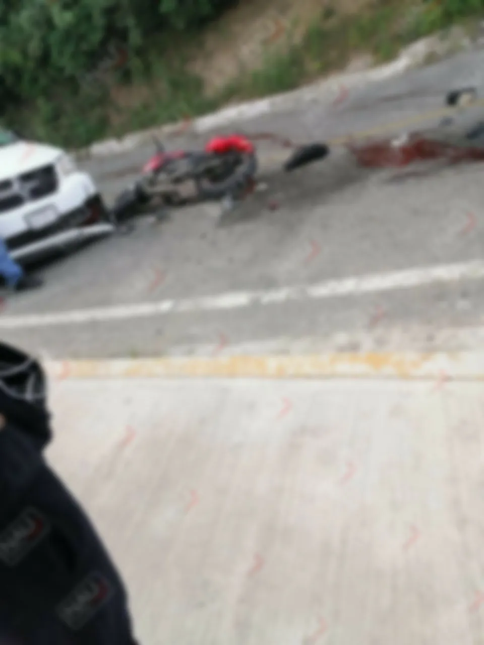 Dos lesionados en choque de motocicleta y un vehículo en Motozintla