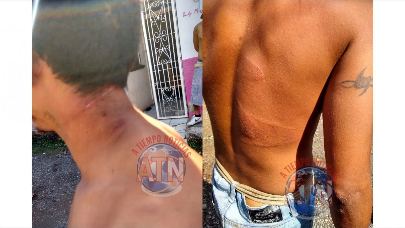 Lesionan con palma de machete a un joven y lo acusan de ratero