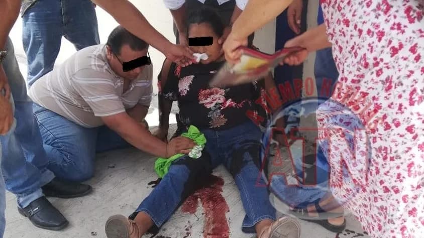 Le dieron tres balazos para robarle 100 mil pesos en la Colonia 5 de Febrero