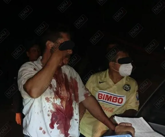 Con lesiones dejan a taxista asaltado