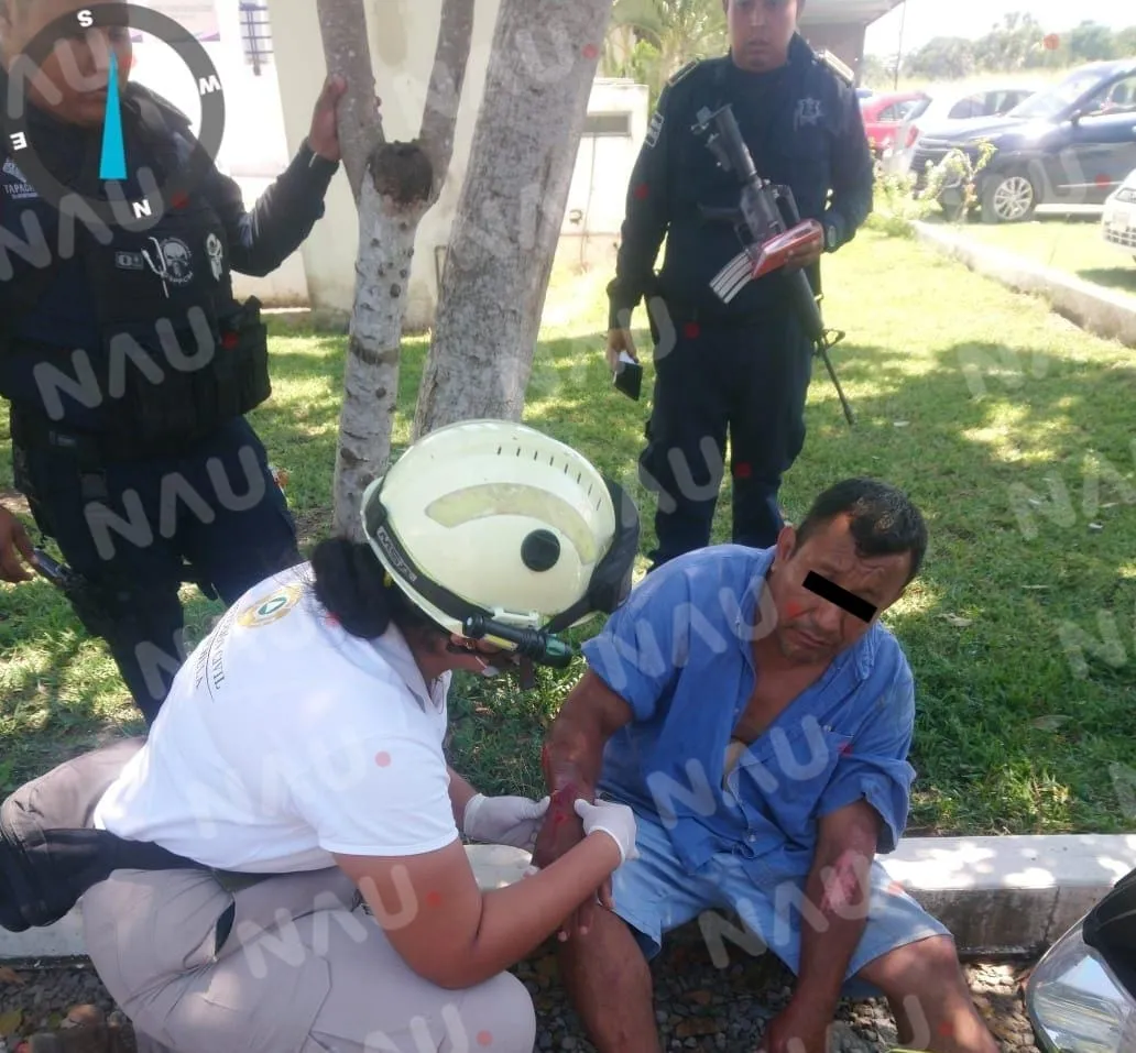 Dos lesionados al derrapar en una motocicleta