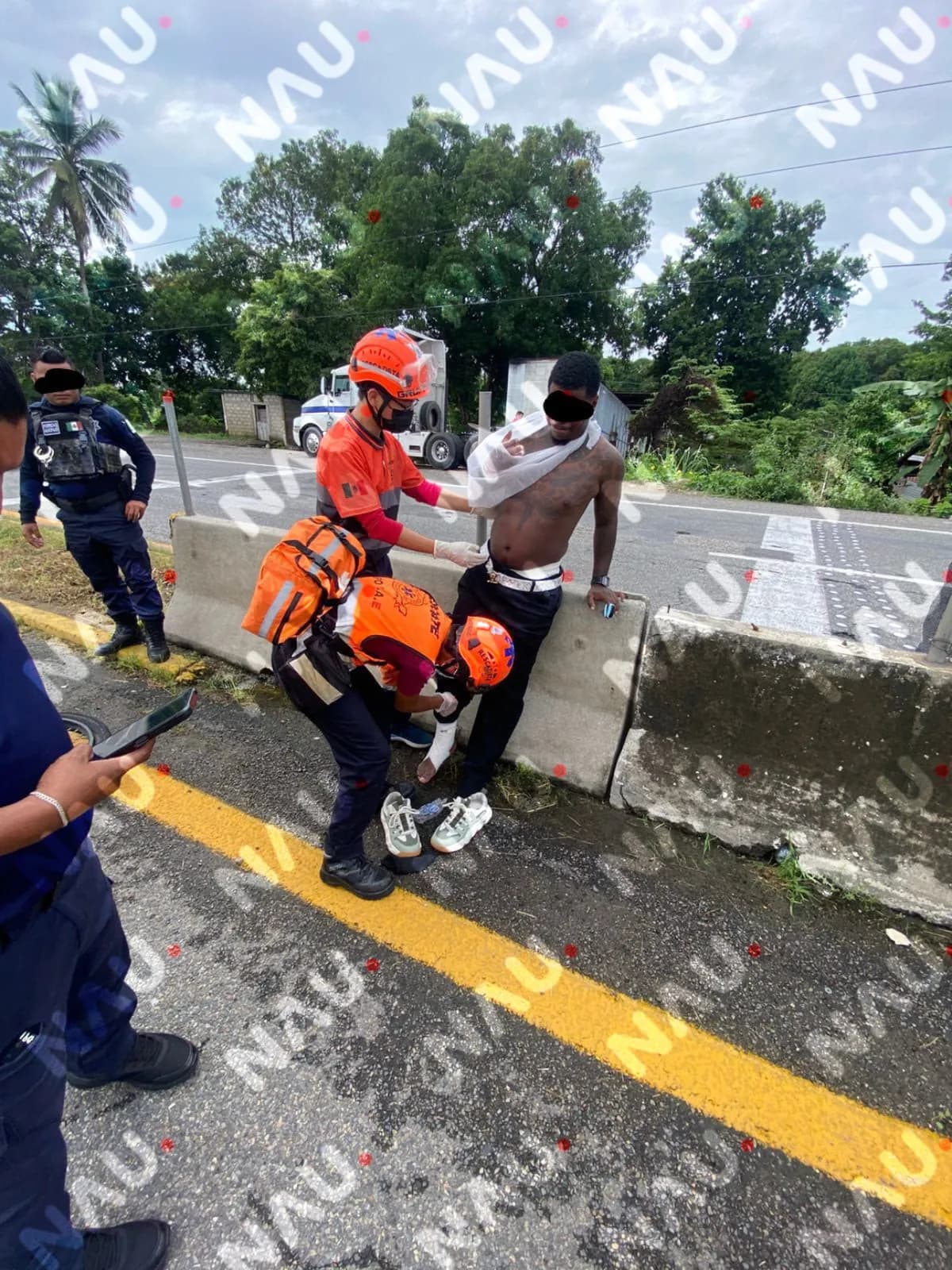 Motociclista resulta lesionado tras ponchadura de llanta en la Carretera Costera
