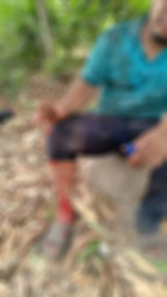 Fue arrollado por un vehículo
