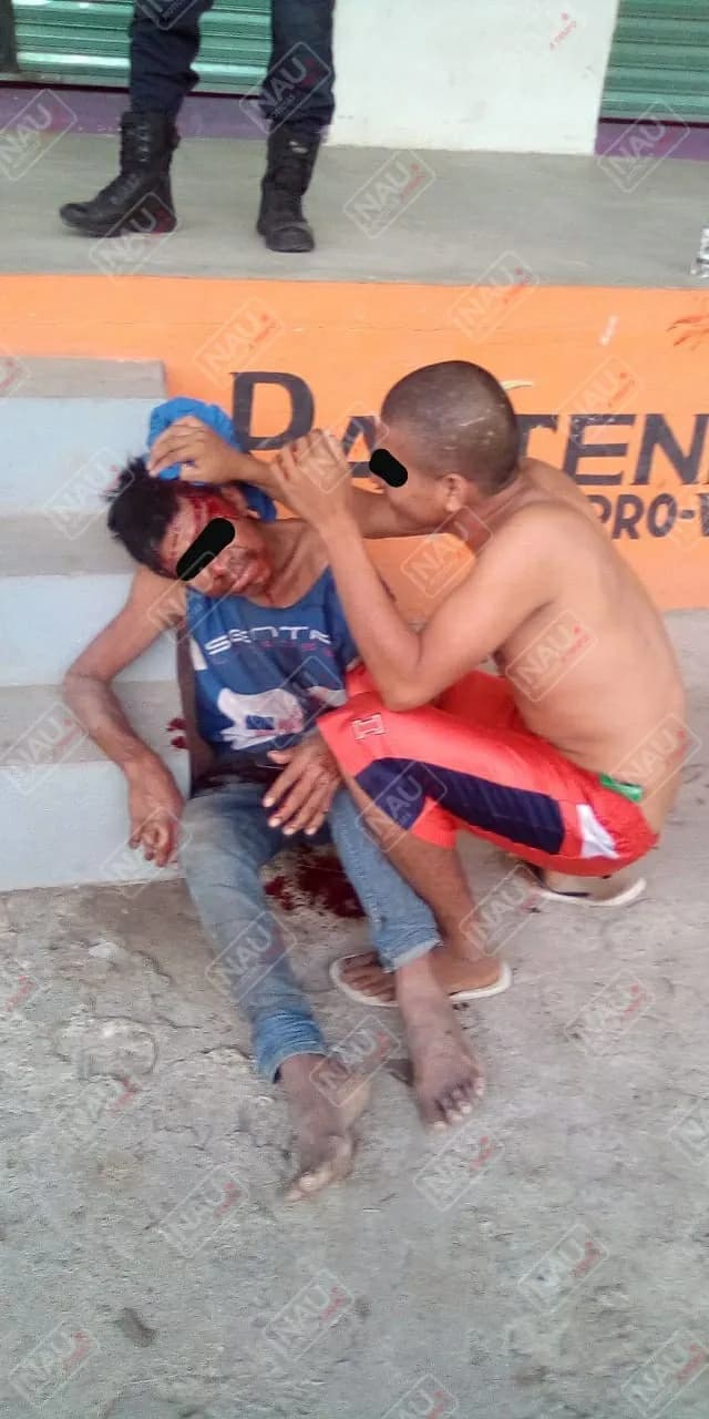 Casi se mata al caer de su propia altura