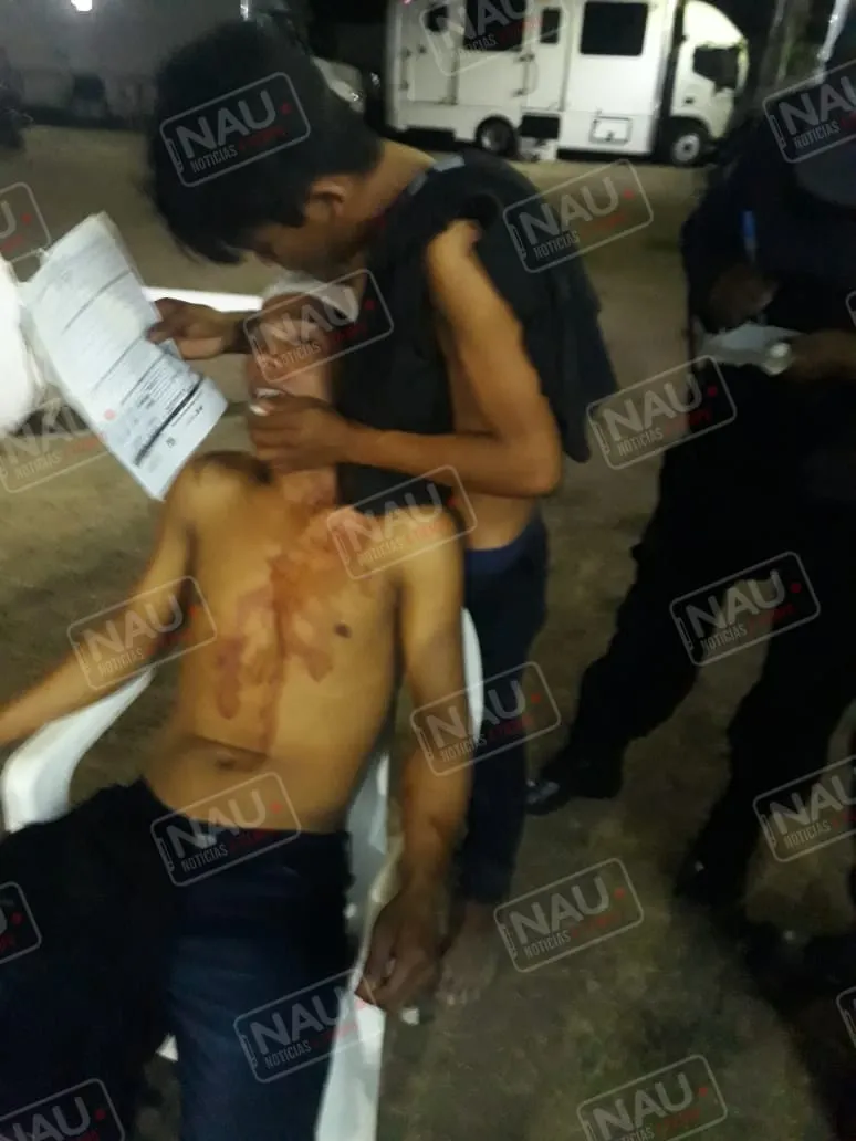 Riña deja un lesionado en la cabeza en Suchiate