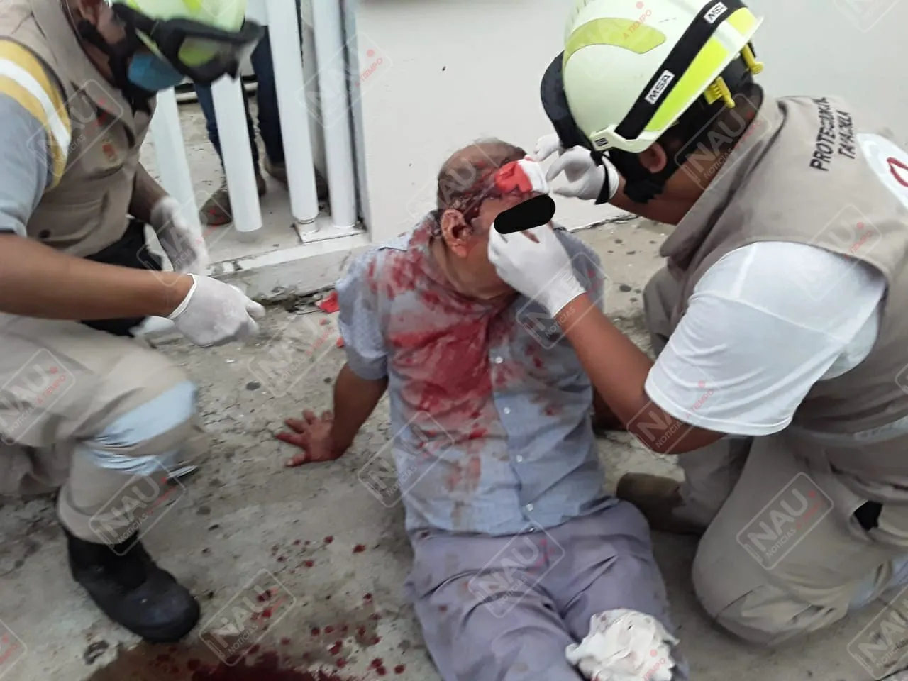 Lo lesionaron al oponerse a ser asaltado