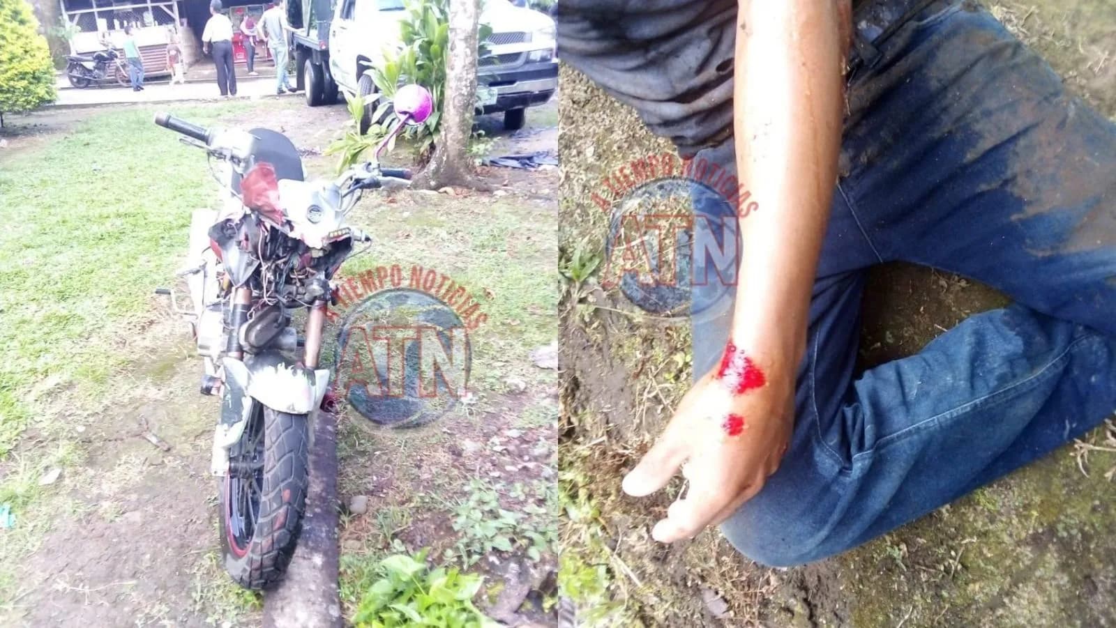 Menor de seis años fue atropellada