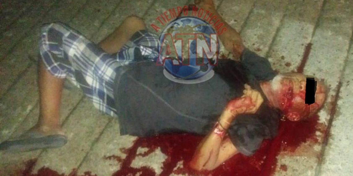 Asesinan a indigente en Escuintla