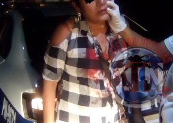 En una riña lesionan a mujer en la mejilla