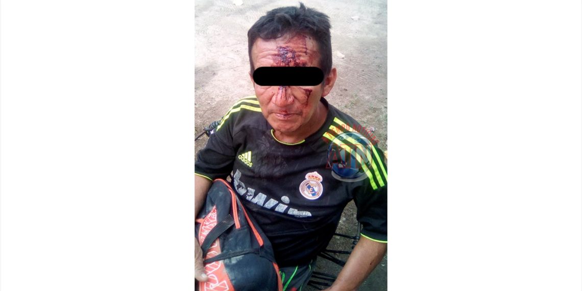 Una persona lesionada en una riña en la Colonia 3 de marzo