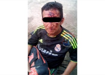 Una persona lesionada en una riña en la Colonia 3 de marzo